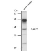 Solarbio K111244P Anti-ASGR1 Polyclonal Antibody