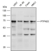 Solarbio K111445P Anti-PTPN22 Polyclonal Antibody