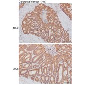 Solarbio K111484P Anti-PRKCD Polyclonal Antibody