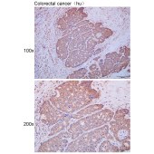 Solarbio K111671P Anti-PBXIP1 Polyclonal Antibody