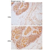 Solarbio K111793P Anti-MTX2 Polyclonal Antibody
