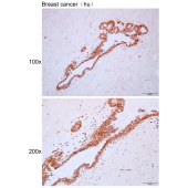 Solarbio K111598P Anti-RANBP6 Polyclonal Antibody