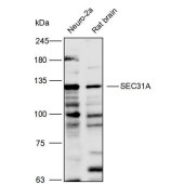 Solarbio K111680P Anti-SEC31A Polyclonal Antibody