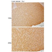 Solarbio K111116P Anti-RNF19A Polyclonal Antibody