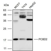 Solarbio K111698P Anti-PCBD2 Polyclonal Antibody