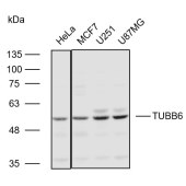 Solarbio K110599P Anti-TUBB6 Polyclonal Antibody