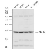 Solarbio K111101P Anti-CDH24 Polyclonal Antibody