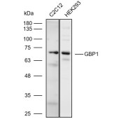 Solarbio K110600P Anti-GBP1 Polyclonal Antibody