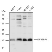 Solarbio K111622P Anti-EIF4EBP1 Polyclonal Antibody