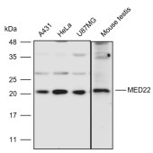 Solarbio K110988P Anti-MED22 Polyclonal Antibody