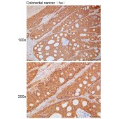 Solarbio K111761P Anti-NDUFB3 Polyclonal Antibody