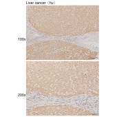 Solarbio K111284P Anti-STAT5B Polyclonal Antibody