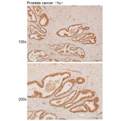 Solarbio K111961P Anti-ELMO1 Polyclonal Antibody