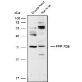 Solarbio K111031P Anti-PPP1R3B Polyclonal Antibody