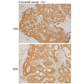 Solarbio K111631P Anti-BIN1 Polyclonal Antibody