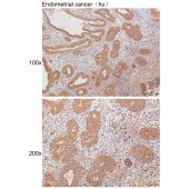 Solarbio K111451P Anti-ACVR2A Polyclonal Antibody