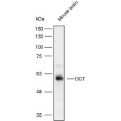 Solarbio K111848P Anti-DCT Polyclonal Antibody