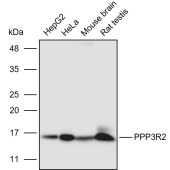 Solarbio K110932P Anti-PPP3R2 Polyclonal Antibody
