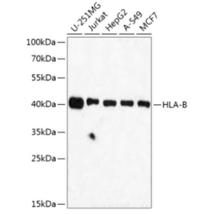 Solarbio K009916P Anti-HLA-B（HLA Class I） Polyclonal Antibody - 试剂仪器耗材