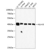 Solarbio K009916P Anti-HLA-B（HLA Class I） Polyclonal Antibody