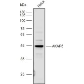 Solarbio K111865P Anti-AKAP5 Polyclonal Antibody