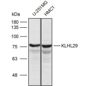 Solarbio K111279P Anti-KLHL29 Polyclonal Antibody