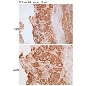 Solarbio K111779P Anti-TRIM16 Polyclonal Antibody