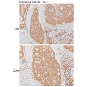 Solarbio K111493P Anti-NRG2 Polyclonal Antibody
