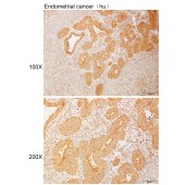 Solarbio K110839P Anti-ABCB7 Polyclonal Antibody
