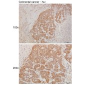 Solarbio K111977P Anti-GALNT14 Polyclonal Antibody