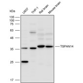 Solarbio K111599P Anti-TSPAN14 Polyclonal Antibody