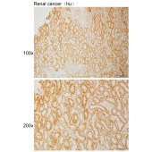 Solarbio K111069P Anti-MID1 Polyclonal Antibody