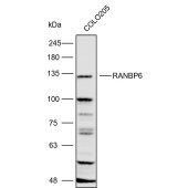 Solarbio K111598P Anti-RANBP6 Polyclonal Antibody