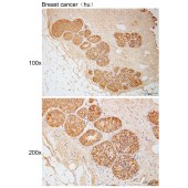 Solarbio K111784P Anti-RABGGTB Polyclonal Antibody