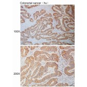 Solarbio K110924P Anti-UQCRQ Polyclonal Antibody