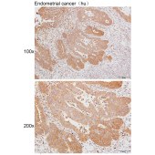 Solarbio K111489P Anti-ARPP21 Polyclonal Antibody