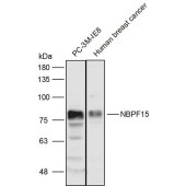 Solarbio K111412P Anti-NBPF15 Polyclonal Antibody