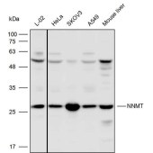 Solarbio K110537P Anti-NNMT Polyclonal Antibody