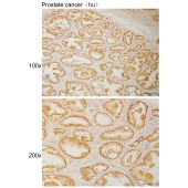 Solarbio K110953P Anti-CBX8 Polyclonal Antibody