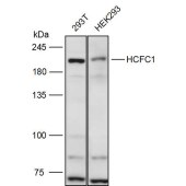 Solarbio K111418P Anti-HCFC1 Polyclonal Antibody