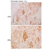 Solarbio K111713P Anti-SNUPN Polyclonal Antibody