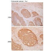 Solarbio K111739P Anti-STK38L Polyclonal Antibody