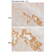 Solarbio K111637P Anti-PLCB3 Polyclonal Antibody