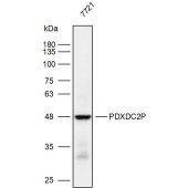 Solarbio K111916P Anti-PDXDC2P Polyclonal Antibody