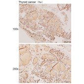 Solarbio K111959P Anti-STX12 Polyclonal Antibody