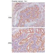 Solarbio K111483P Anti-AKAP10 Polyclonal Antibody