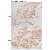 Solarbio K111293P Anti-NCAM2 Polyclonal Antibody