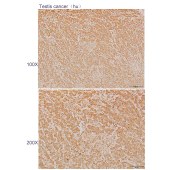 Solarbio K110560P Anti-SH3GL3 Polyclonal Antibody