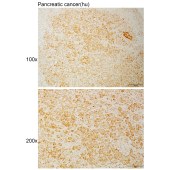 Solarbio K111044P Anti-TMBIM1 Polyclonal Antibody
