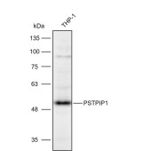 Solarbio K112105P Anti-PSTPIP1 Polyclonal Antibody